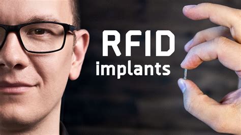 can rfid chip be removed|illegal rfid chip implantation.